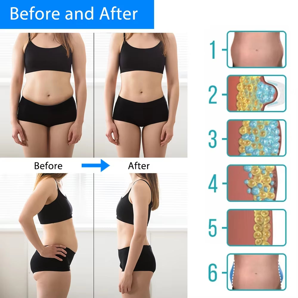Transform Your Body with Our Advanced Cryotherapy Fat Freezer Massager – Say Goodbye to Cellulite and Hello to a Slimmer Figure!